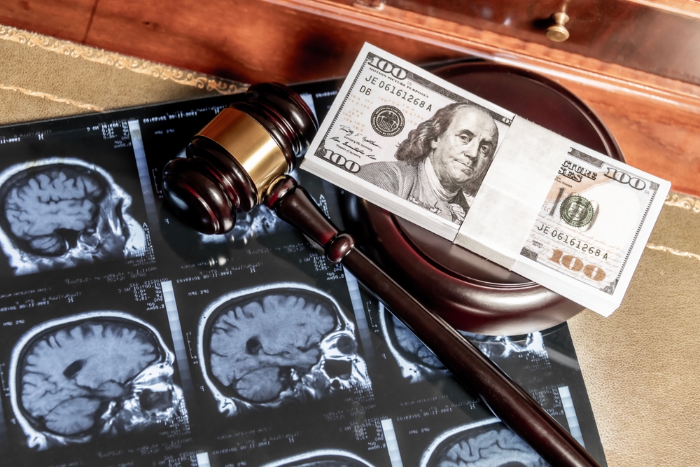 Traumatic Brain Injury Lawyer in Fort Lauderdale, Florida